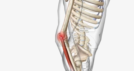 Téléchargez les photos : Tennis elbow, also called epicondylitis, is a painful condition caused by repetitive movement of the elbow. 3D rendering - en image libre de droit