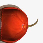 Keratoconus is an eye disease that affects the structure of the cornea. 3D rendering