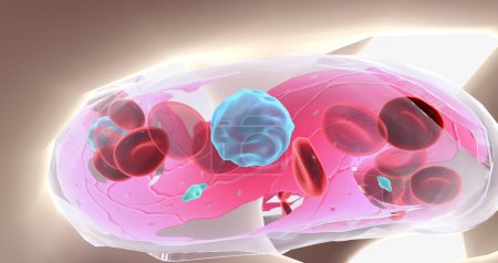 Aplastic anemia is a blood disease characterized by the reduced production of blood cells. 3D rendering