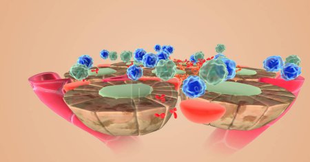 Photo for Autoimmune attack on thyroid cells 3D rendering - Royalty Free Image