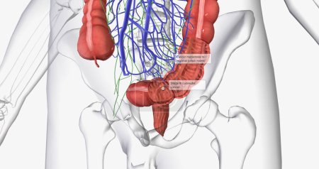 Photo for Colorectal cancer (CRC) is a common colon or rectal cancer that affects many patients over middle age. 3D rendering - Royalty Free Image