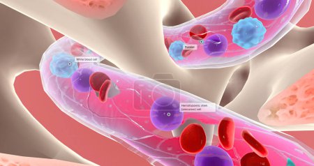 Photo for Lymphoblasts invaded and eventually replace healthy bone marrow, preventing the production of blood cells. 3D rendering - Royalty Free Image