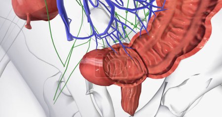 Photo for Colorectal cancer (CRC) is a common colon or rectal cancer that affects many patients over middle age. 3D rendering - Royalty Free Image