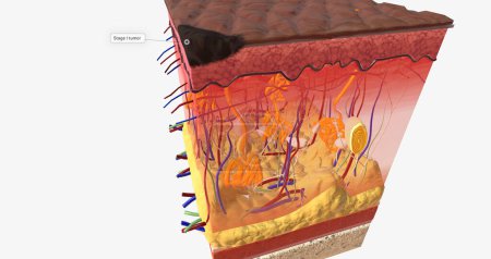 Photo for In Stage I ALM, the tumor is very small and located on the top-most layer of the skin, the epidermis. 3D rendering - Royalty Free Image