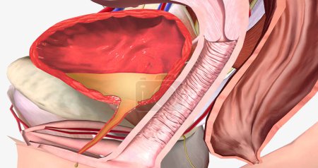 Téléchargez les photos : Weakened urethra and surrounding support structures allow urine to leak out of bladder 3D rendering - en image libre de droit