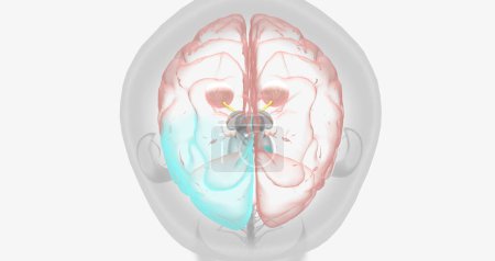 Téléchargez les photos : Damaged optic nerve leads to disrupted signaling to brain 3D rendering - en image libre de droit