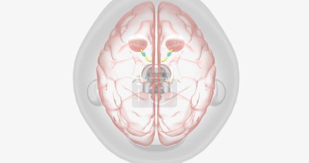 Téléchargez les photos : Damaged optic nerve leads to disrupted signaling to brain 3D rendering - en image libre de droit