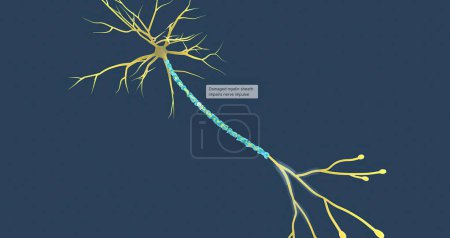 Téléchargez les photos : Damaged myelin sheath impairs nerve impulse 3D rendering - en image libre de droit
