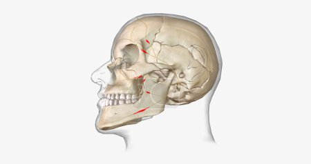 Téléchargez les photos : Swollen facial nerve in stylomastoid foramen 3D rendering - en image libre de droit