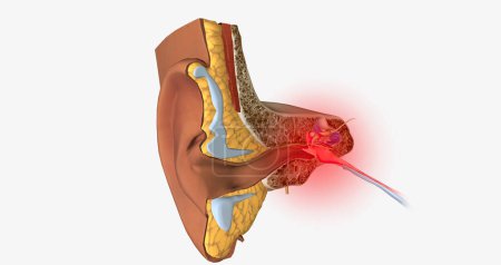 Téléchargez les photos : Earache is a general term for pain in the ear.3D rendering - en image libre de droit