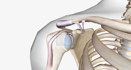 A superior labral tear is when a lesion is found in the upper portion for the labrum.3D rendering