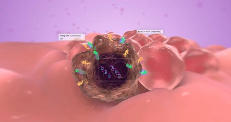Foto de The abnormal gene is known as an oncogene because it causes tumor growth. 3D rendering - Imagen libre de derechos