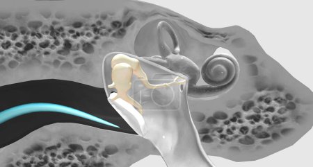 Photo for The auditory ossicles amplify all sound vibrations moving into the inner ear.3D rendering - Royalty Free Image