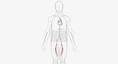 Foto de Las arterias para la inserción del catéter 3D Render - Imagen libre de derechos