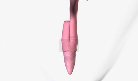 Téléchargez les photos : La chirurgie d'anastomose iléoanale permet d'enlever les parties supérieure et inférieure du gros intestin. Rendu 3D - en image libre de droit