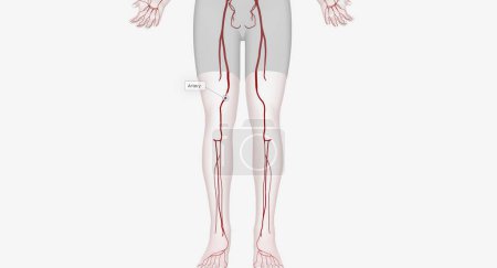 Téléchargez les photos : Les interventions artérielles des membres inférieurs sont des interventions visant à rétablir le flux sanguin vers les jambes et les pieds. rendu 3D - en image libre de droit