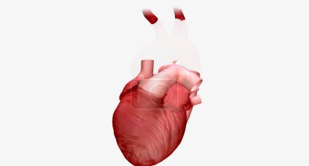 Téléchargez les photos : Une greffe synthétique est un tube artificiel qui permet au sang oxygéné de circuler du cœur vers le reste du corps. rendu 3D - en image libre de droit