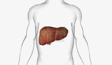 PBC is characterized by autoimmune destruction of the small and medium sized bile ducts in the liver. 3D rendering