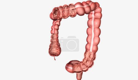 Téléchargez les photos : Le gros intestin est une structure creuse dans l'abdomen qui entoure l'intestin grêle. rendu 3D - en image libre de droit