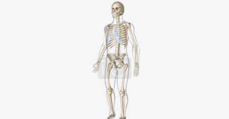 Photo for Paget's disease of the bone (PDB) is a skeletal disorder characterized by abnormal bone growth. 3D rendering - Royalty Free Image
