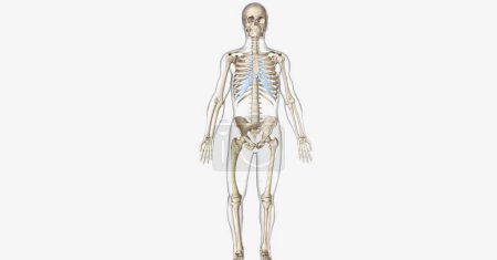 Photo for Paget's disease of the bone (PDB) is a skeletal disorder characterized by abnormal bone growth. 3D rendering - Royalty Free Image