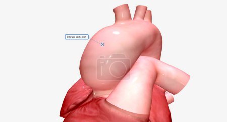 Photo for The aortic arch connects the ascending aorta to the descending aorta. 3D rendering - Royalty Free Image
