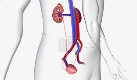 Photo for Kidney stones can become painful when traveling through the urinary tract but do not usually cause lasting damage. 3D Rendering - Royalty Free Image