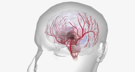 Hämorrhagischer Schlaganfall ist eine dringende Erkrankung, die durch Blutungen innerhalb oder an der Oberfläche des Gehirns gekennzeichnet ist.3D-Rendering