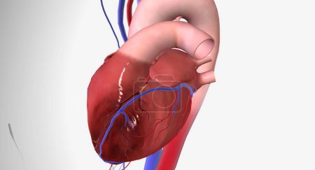 Photo for Angina is chest pain or discomfort due to reduced blood flow to the heart. 3D rendering - Royalty Free Image