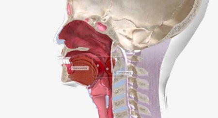Foto de La anafilaxia es una reacción alérgica sistémica grave caracterizada por hinchazón de la cara, la lengua, la garganta o las vías respiratorias. Renderizado 3D - Imagen libre de derechos