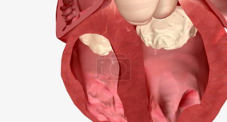 Téléchargez les photos : Le septum du cœur est la paroi musculaire qui sépare le ventricule droit du ventricule gauche, les deux chambres inférieures du cœur. rendu 3D - en image libre de droit
