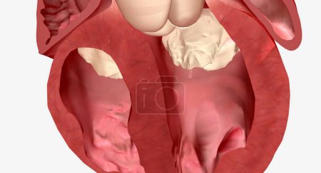 Photo for The septum of the heart is the muscular wall that separates the right ventricle from the left ventricle, the two bottom chambers of the heart. 3D rendering - Royalty Free Image
