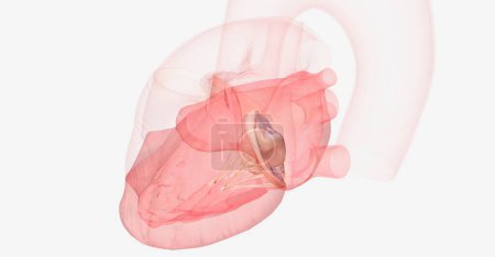 Foto de El prolapso de la válvula mitral puede hacer que la sangre fluya hacia atrás desde el ventrículo izquierdo hacia la aurícula izquierda. Renderizado 3D - Imagen libre de derechos
