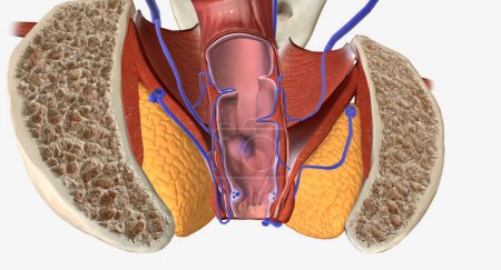 Photo for Hemorrhoids are a common condition characterized by swollen blood vessels in the anal canal or lower rectum. 3D rendering - Royalty Free Image