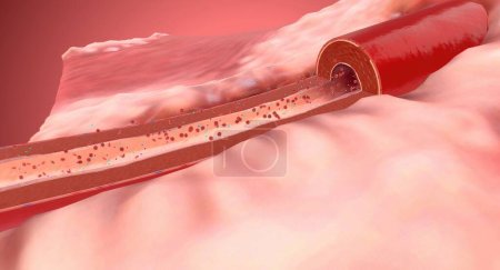 Photo for Sodium and Aldosterone, High Blood Pressure. 3D rendering - Royalty Free Image