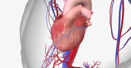 Téléchargez les photos : L'ischémie myocardique est causée par une diminution du flux sanguin vers le cœur et un manque d'oxygène dans le muscle cardiaque. rendu 3D - en image libre de droit