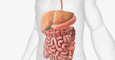 Photo for Nonalcoholic Fatty Liver Disease (NAFLD) is a condition in which excess fat cells are stored in the liver. 3D rendering - Royalty Free Image