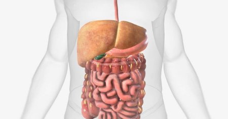 La enfermedad del hígado graso no alcohólico (NAFLD, por sus siglas en inglés) es una afección en la que se almacenan células grasas en exceso en el hígado. Renderizado 3D
