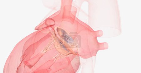 Foto de El prolapso de la válvula mitral puede hacer que la sangre fluya hacia atrás desde el ventrículo izquierdo hacia la aurícula izquierda. Renderizado 3D - Imagen libre de derechos