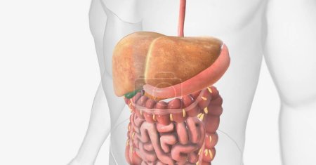 Photo for Nonalcoholic Fatty Liver Disease (NAFLD) is a condition in which excess fat cells are stored in the liver. 3D rendering - Royalty Free Image