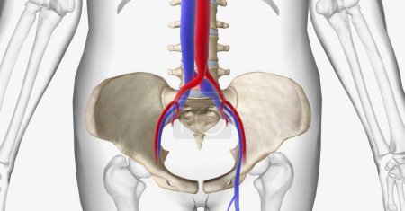Das May-Thurner-Syndrom ist eine Kompression der linken Gallenvene zwischen der rechten Gallenarterie und dem 5. Lendenwirbel der Wirbelsäule. 3D-Rendering