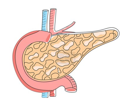 Illustration for Pancreas with arteries are shown in doodle style. Internal organ of digestive system on white background. Health care icon vector in flat style for landing page, website, app, banner. - Royalty Free Image