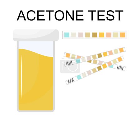 Téléchargez les illustrations : Jeu de vecteurs de test d'acétone. Icône de test d'urine. Test de jauge utilisé pour déterminer les changements pathologiques. Illustration médicale pour web, app. - en licence libre de droit