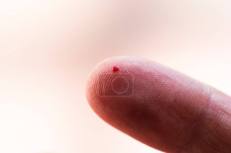 Photo for Small wound on the tip of the index finger from which blood is oozing. Method to check blood sugar for diabetes. - Royalty Free Image