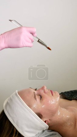 A professional beautician makes a Carboxing bone mask for the face and neck of a client of a carboxytherapy patient, close-up