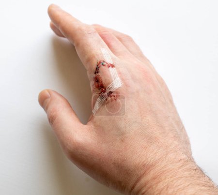 Foto de Vista detallada de un dedo herido con coyuntura, sangre filtrándose, sobre un fondo blanco - Imagen libre de derechos