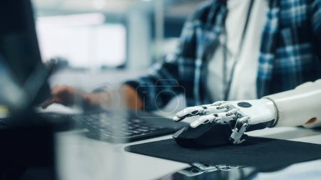 Diverse Body Positive Office: Woman with Disability Using Prosthetic Arm to Work on Computer. Professional with Futuristic Thought Controlled Myoelectric Bionic Hand.