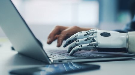 Photo for Close-up on Hands: Person with Disability Using Prosthetic Arm to Work on Laptop Computer. Specialist Swift and Natural Use of Thought Controlled Body Powered Myoelectric Bionic Hand. - Royalty Free Image