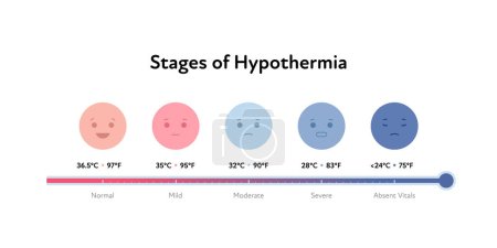 Frostbite and hypothermia health care infographic collection. Vector flat healthcare illustration. Red and blue human face smile avatar icon. Body temperature for stages. Celsius and fahrenheit symbol