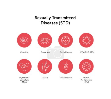 Ilustración de Infografía de enfermedades de transmisión sexual. Conjunto de iconos de ilustración sanitaria plana vectorial. Tipos de infección por ETS. VIH, VPH, clamidia, gonorrea, herpes, micoplasma, símbolo de sífilis. Diseño para la atención sanitaria - Imagen libre de derechos